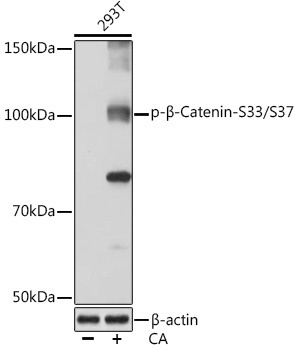 Phospho-Beta-Catenin-S33/S37 Rabbit Monoclonal Antibody