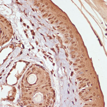 Phospho-Beta-Catenin-S33/S37/T41 Rabbit Polyclonal Antibody - Image 2