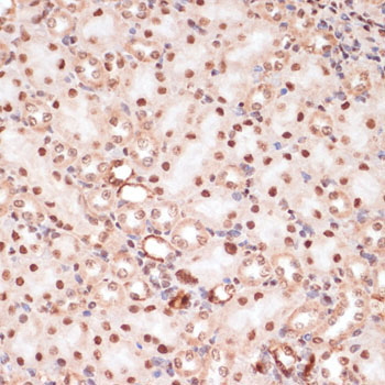 Phospho-Beta-Catenin-S33/S37/T41 Rabbit Polyclonal Antibody - Image 3