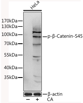 Phospho-Beta-Catenin-S45 Rabbit Polyclonal Antibody