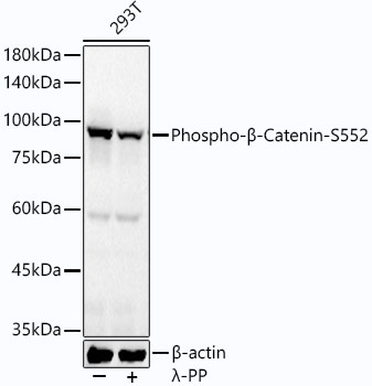 Phospho-Beta-Catenin-S552 Rabbit Monoclonal Antibody