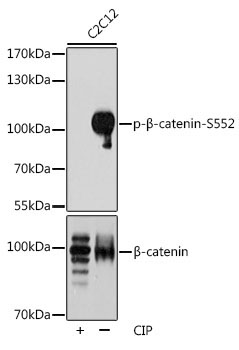 Phospho-Beta-Catenin-S552 Rabbit Polyclonal Antibody - Image 2