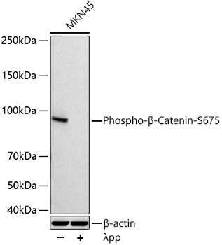 Phospho-Beta-Catenin-S675 Rabbit Polyclonal Antibody