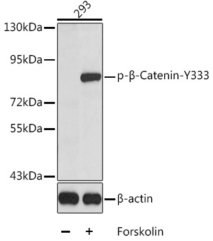 Phospho-Beta-Catenin-Y333 Rabbit Polyclonal Antibody