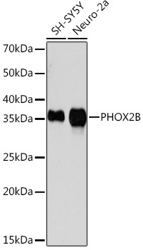 PHOX2B Rabbit Monoclonal Antibody