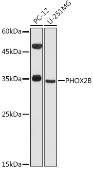 PHOX2B Rabbit Polyclonal Antibody