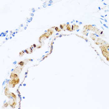 PHPT1 Rabbit Polyclonal Antibody - Image 2
