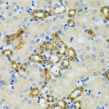 PHPT1 Rabbit Polyclonal Antibody - Image 3