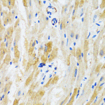 PHPT1 Rabbit Polyclonal Antibody - Image 4