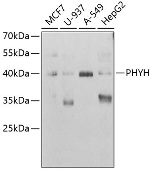 PHYH Rabbit Polyclonal Antibody