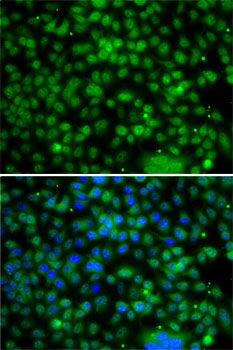 PHYHD1 Rabbit Polyclonal Antibody - Image 2