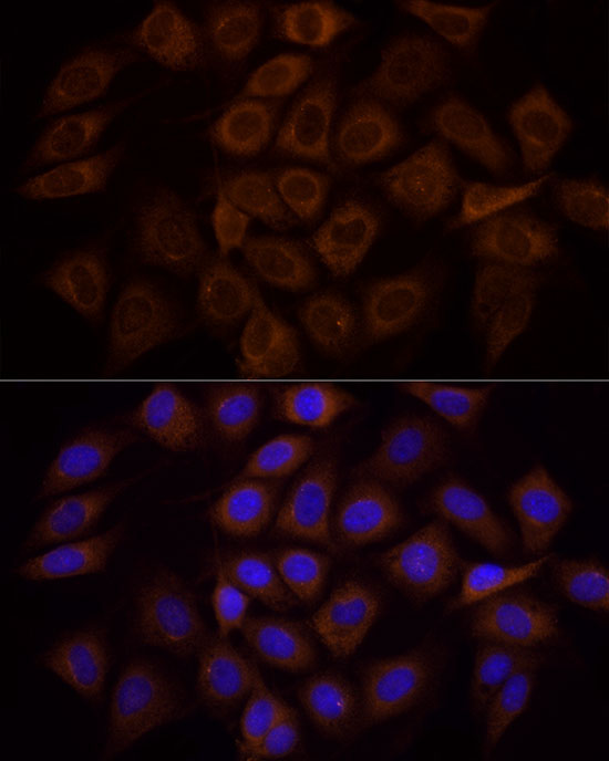 PI3 Kinase p85 alpha Rabbit Polyclonal Antibody - Image 2