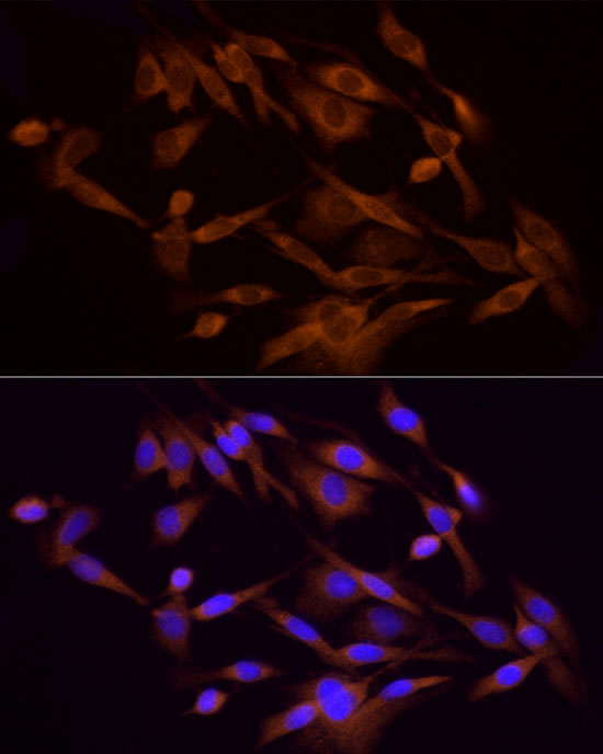 PI3 Kinase p85 alpha Rabbit Polyclonal Antibody - Image 3
