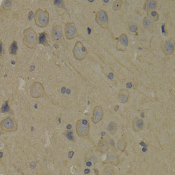 PI3 Kinase p85 alpha Rabbit Polyclonal Antibody - Image 6