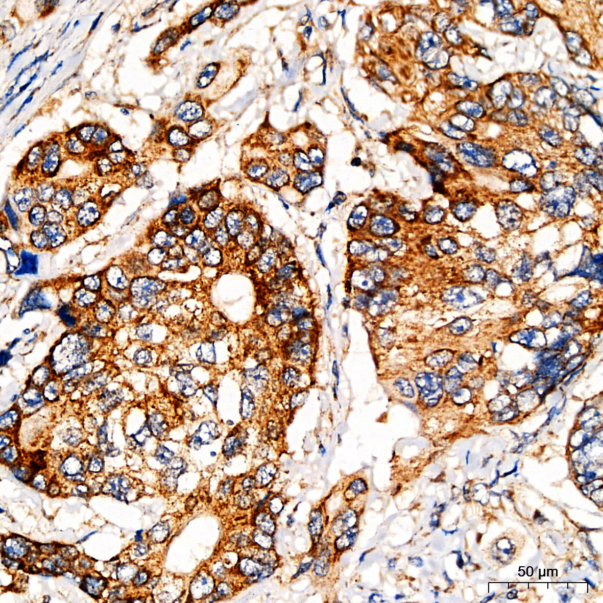 PI3 Kinase p85 alpha Rabbit Polyclonal Antibody - Image 7