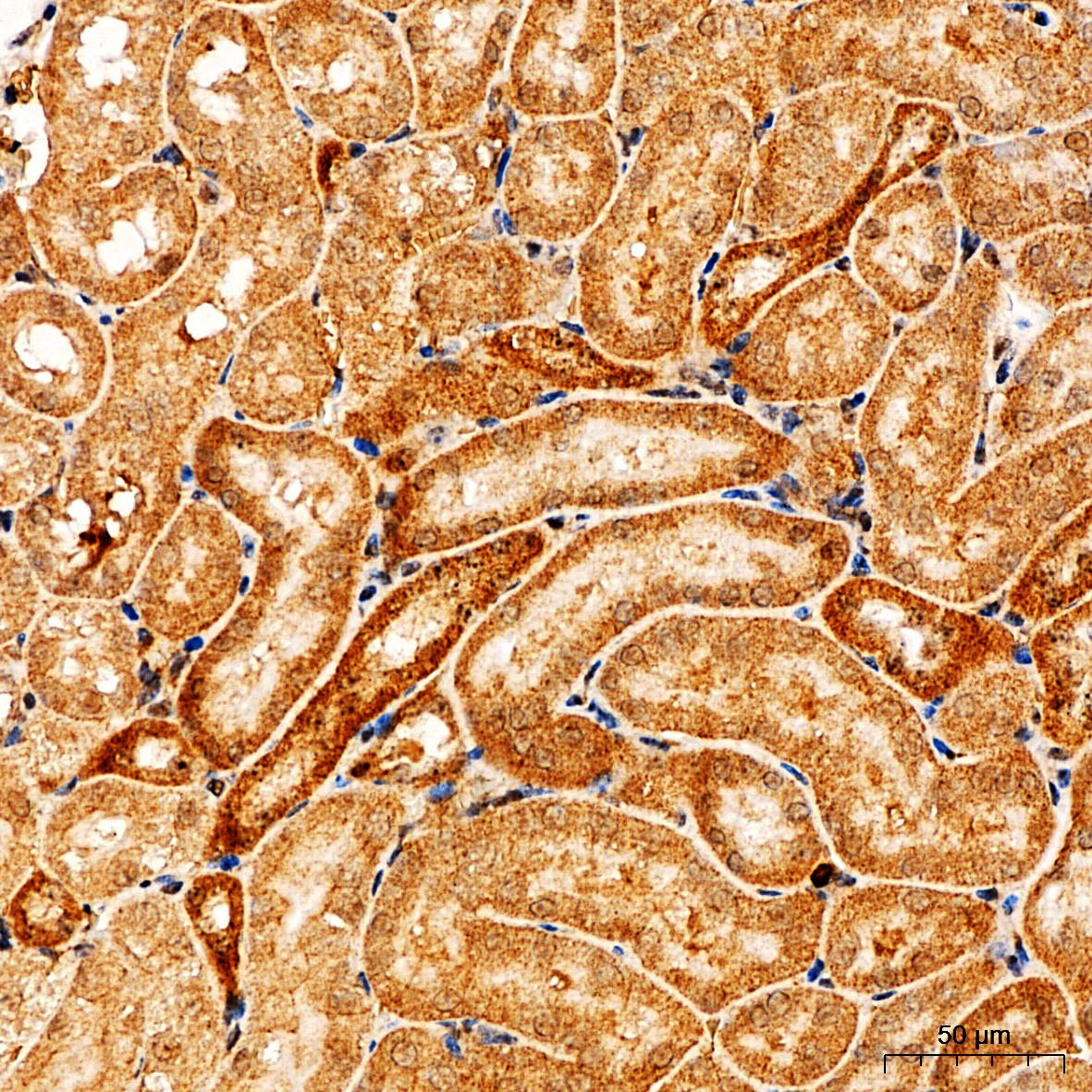 PI3 Kinase p85 alpha Rabbit Polyclonal Antibody - Image 8