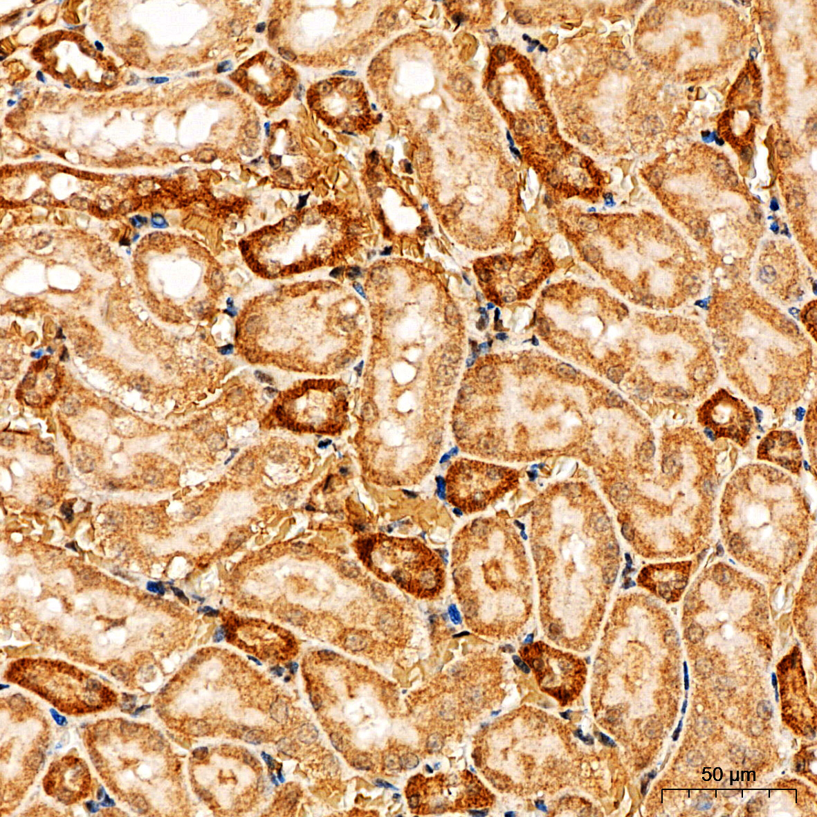 PI3 Kinase p85 alpha Rabbit Polyclonal Antibody - Image 9