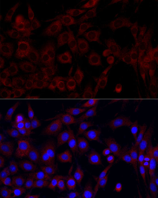 PI3 Kinase p85 alpha Rabbit Polyclonal Antibody - Image 10