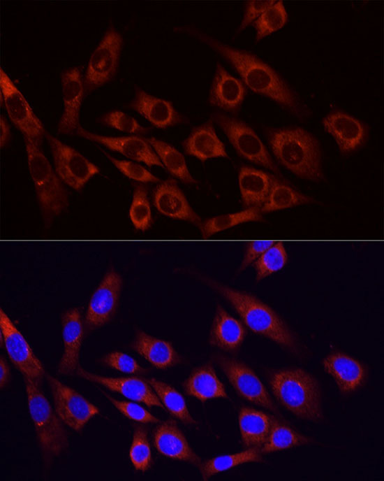 PI3 Kinase p85 alpha Rabbit Polyclonal Antibody - Image 11