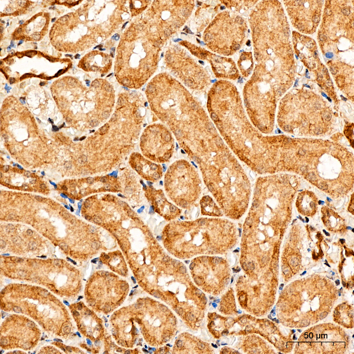 PI3 Kinase p85 alpha Rabbit Polyclonal Antibody - Image 3