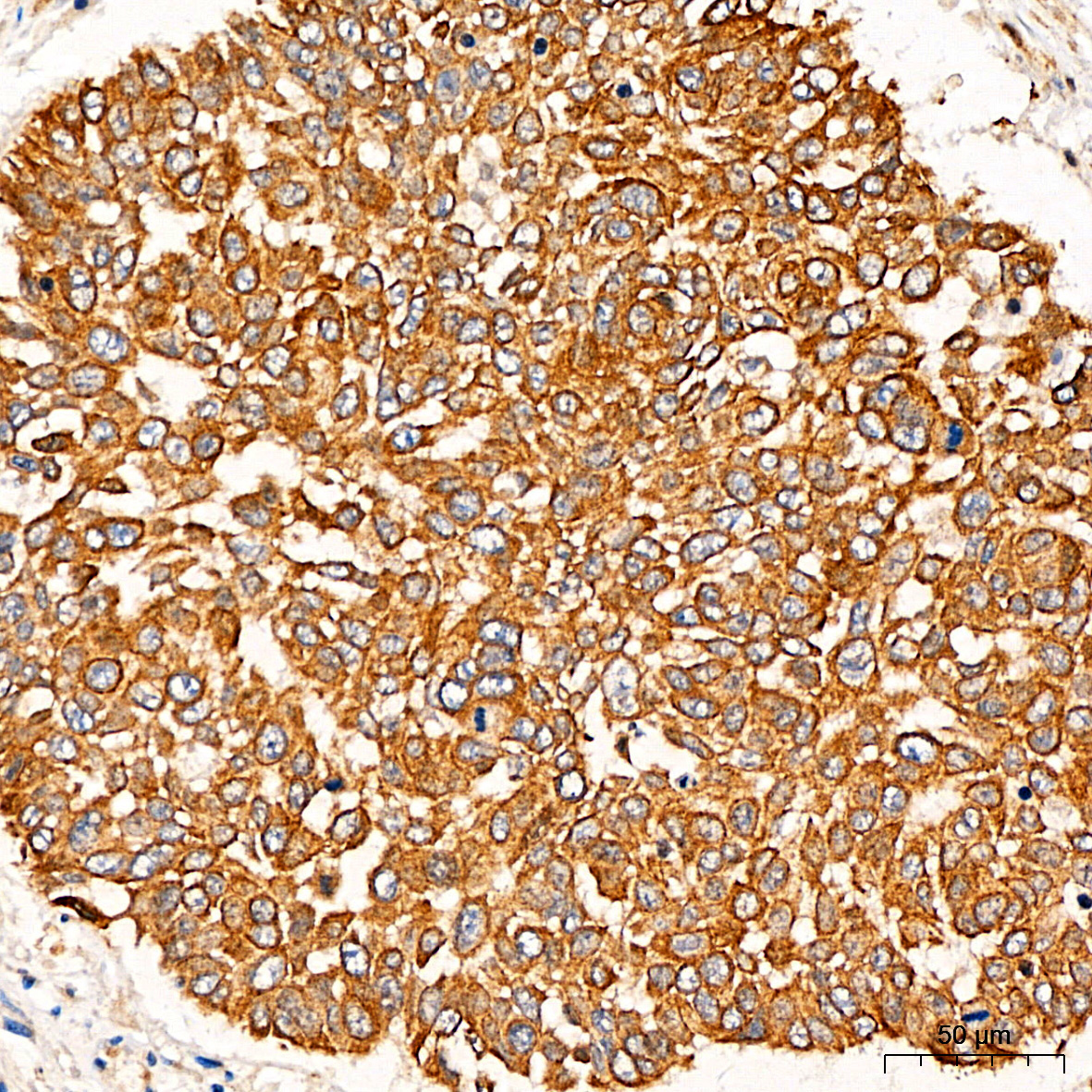 PI3 Kinase p85 alpha Rabbit Polyclonal Antibody - Image 4
