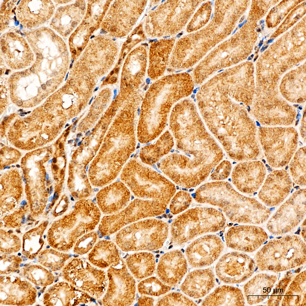 PI3 Kinase p85 alpha Rabbit Polyclonal Antibody - Image 5