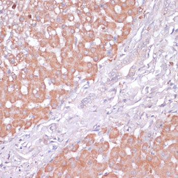PI3 Kinase p85 beta Rabbit Polyclonal Antibody - Image 2