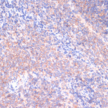 PI3 Kinase p85 beta Rabbit Polyclonal Antibody - Image 3