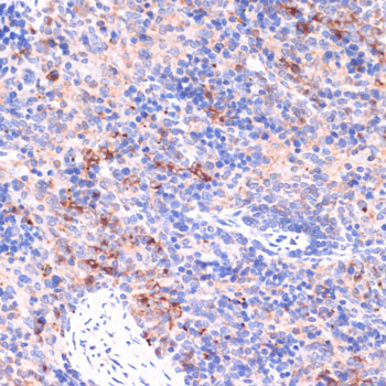 PI3 Kinase p85 beta Rabbit Polyclonal Antibody - Image 4