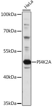 PI4K2A Rabbit Polyclonal Antibody