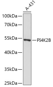 PI4K2B Rabbit Polyclonal Antibody