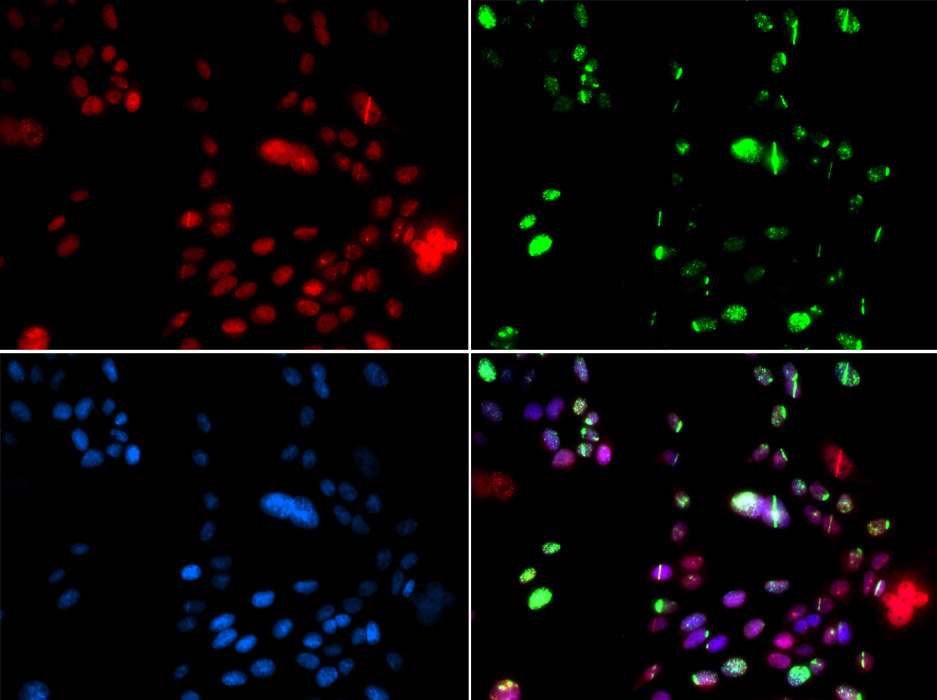 PIAS1 Rabbit Polyclonal Antibody
