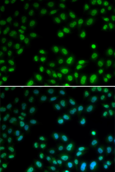 PIAS1 Rabbit Polyclonal Antibody - Image 2