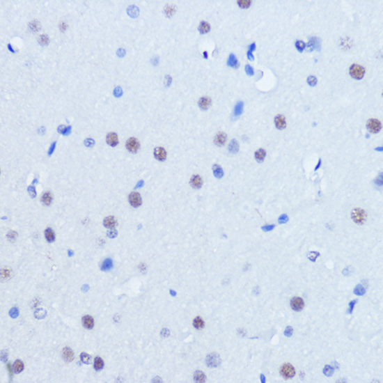 PIAS2 Rabbit Polyclonal Antibody - Image 2