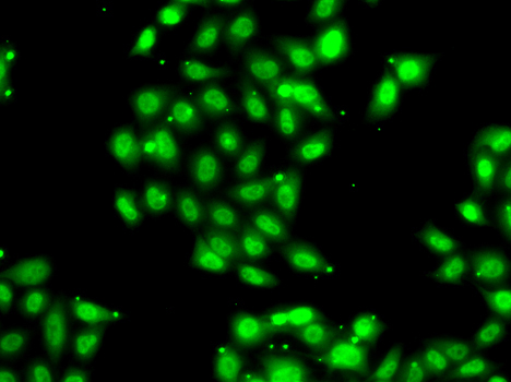 PIAS3 Rabbit Polyclonal Antibody