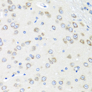 PIAS3 Rabbit Polyclonal Antibody - Image 3