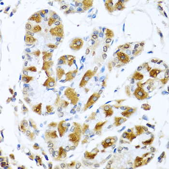 PIAS3 Rabbit Polyclonal Antibody - Image 4