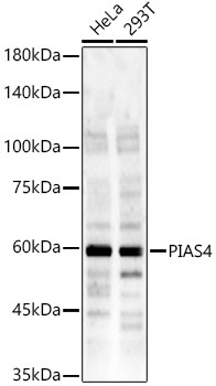 PIAS4 Rabbit Polyclonal Antibody