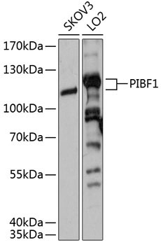 PIBF1 Rabbit Polyclonal Antibody