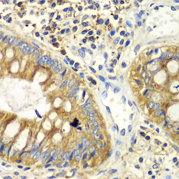 PICK1 Rabbit Polyclonal Antibody