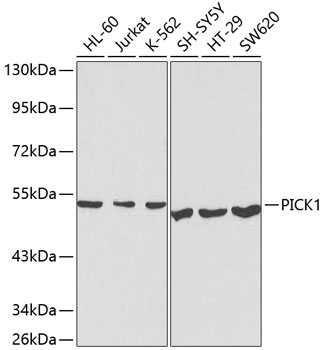 PICK1 Rabbit Polyclonal Antibody