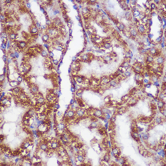 PIGM Rabbit Polyclonal Antibody - Image 2