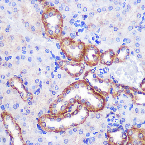 PIGM Rabbit Polyclonal Antibody - Image 3