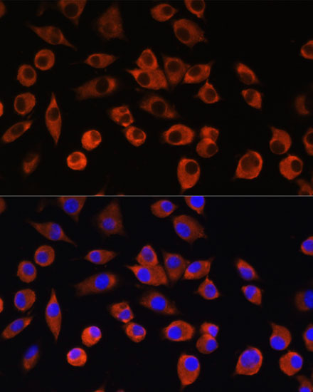 PIGM Rabbit Polyclonal Antibody - Image 4