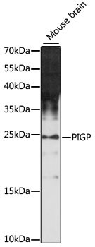 PIGP Rabbit Polyclonal Antibody