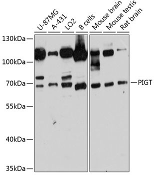 PIGT Rabbit Polyclonal Antibody