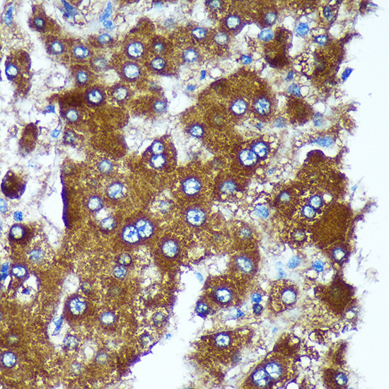 PIGU Rabbit Polyclonal Antibody - Image 2