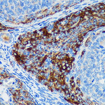 PIGU Rabbit Polyclonal Antibody - Image 3