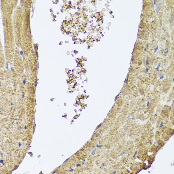 PIK3C2A Rabbit Polyclonal Antibody - Image 2