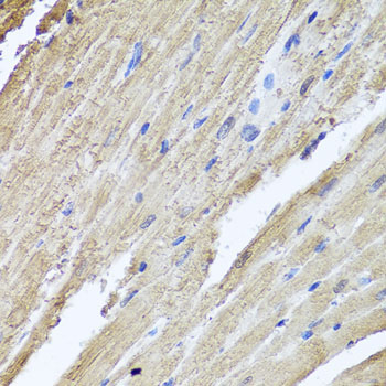 PIK3C2A Rabbit Polyclonal Antibody - Image 3